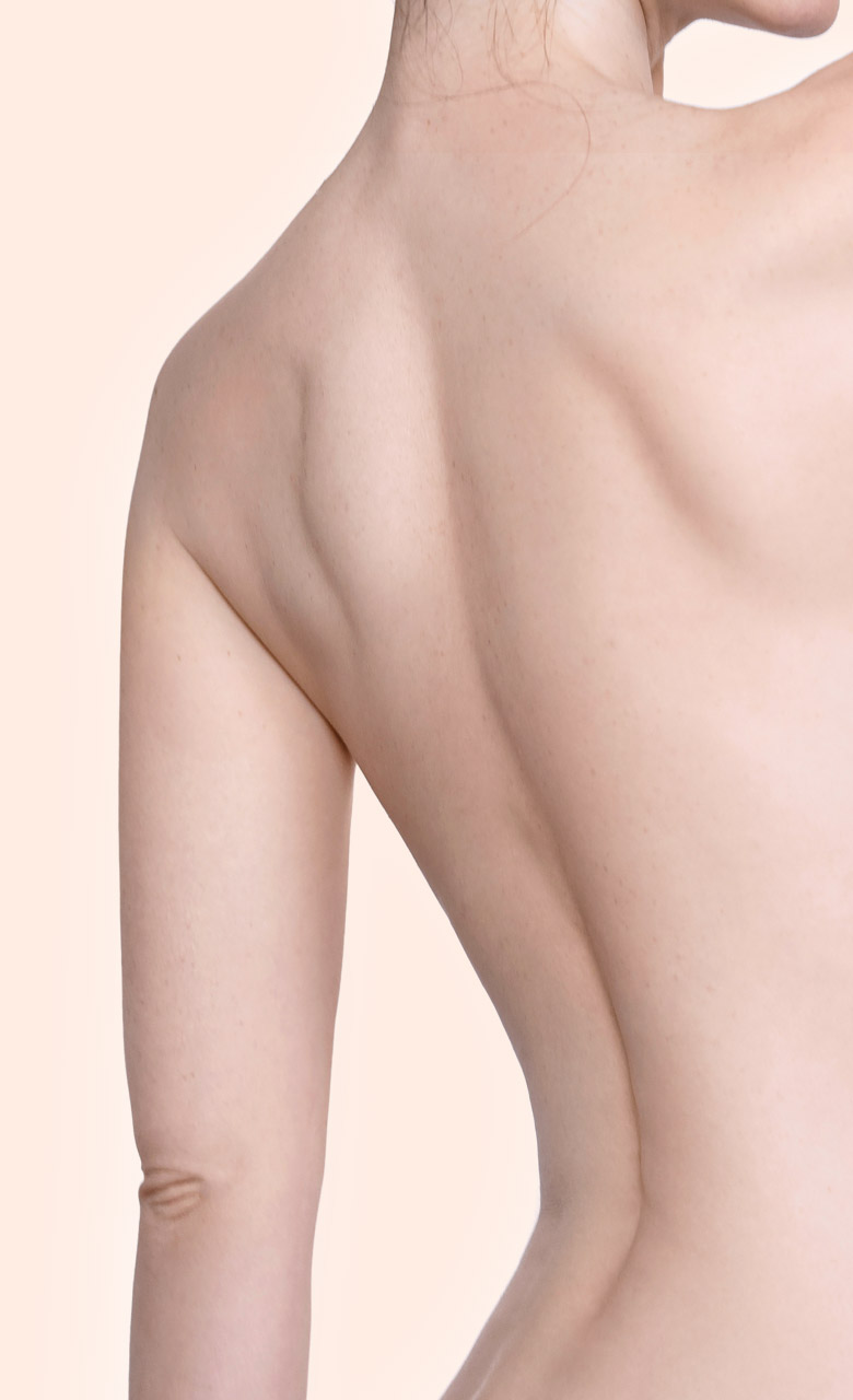 Dos d'une femme afin d'illustrer la chirurgie esthétique du corps pratiqué chez Concept Clinic à Genève par le Dr. Schlaudraff